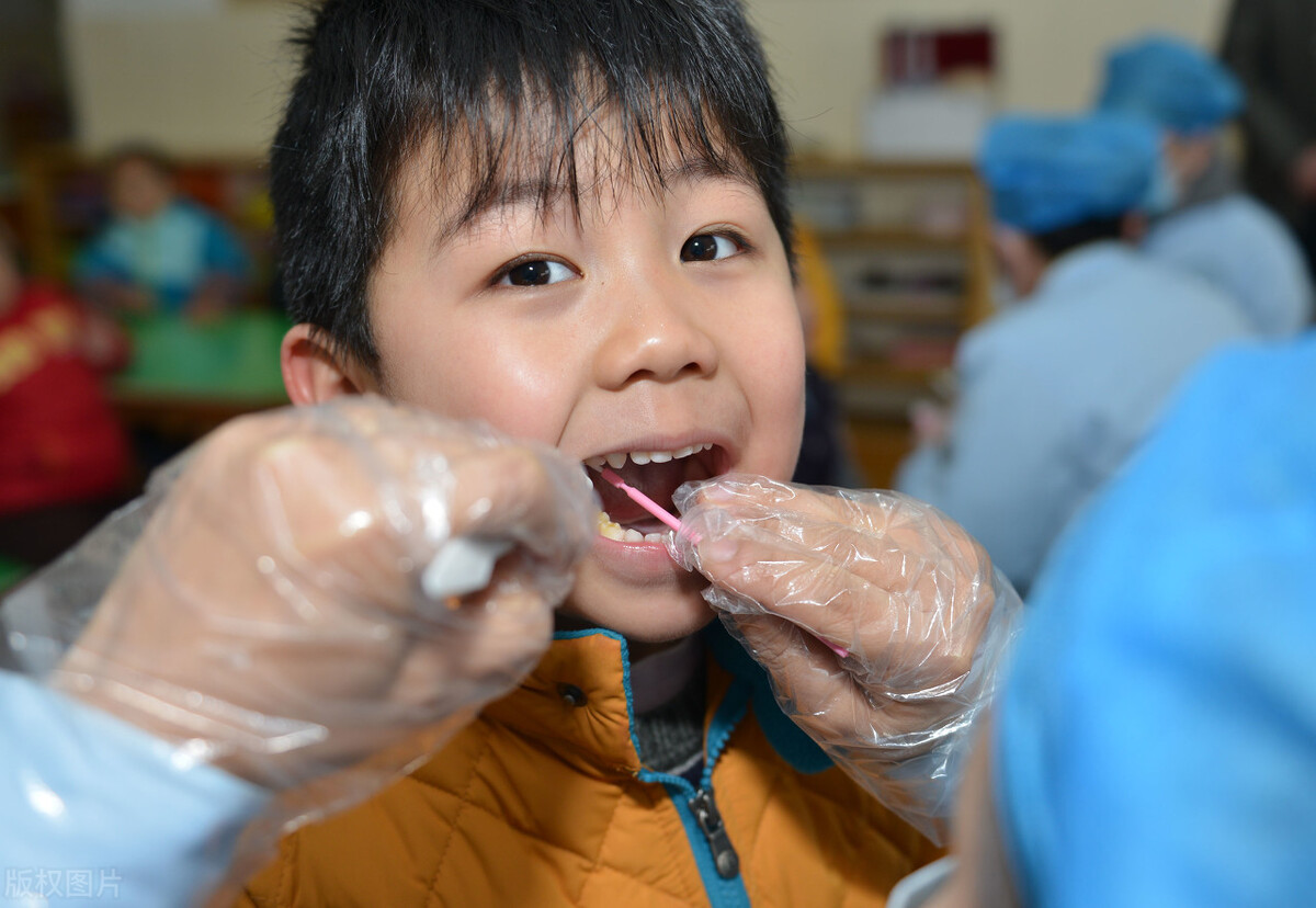 牙齿涂氟的危害,牙齿涂氟后多长时间可以进食