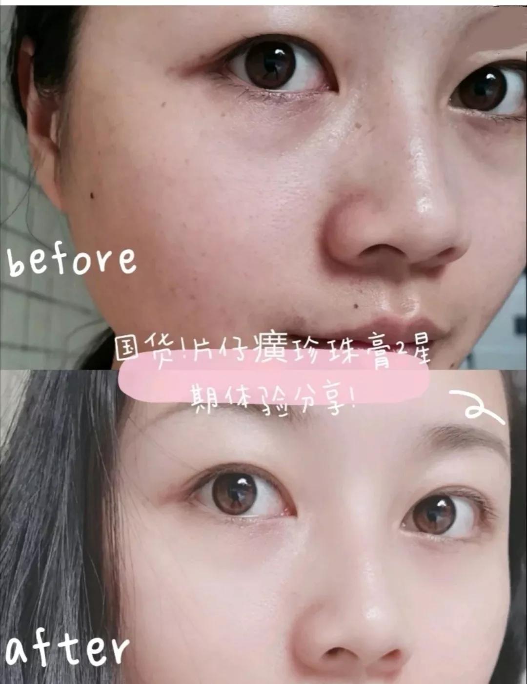 美容护肤知识达人推荐,珍珠膏真的能美容吗