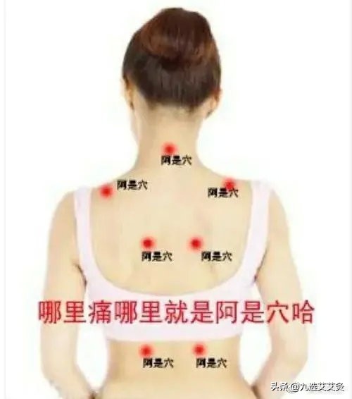 面部艾灸后皮肤痒和起疙瘩,艾灸治疗皮肤肿痒