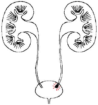 尿液发红是怎么回事正常吗,尿液发红是怎么了