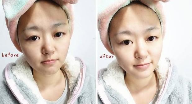 艾喏莎珍珠膏功效,艾喏莎珍珠膏测评