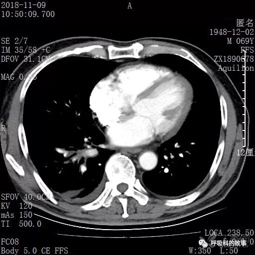 怎么应用统计学做调查,统计学方法可以解决的主要问题