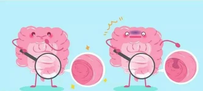 便血不止,大娘当“痔疮”越治越严重!肠镜王子“内镜绝技”巧除肠内巨大肿瘤