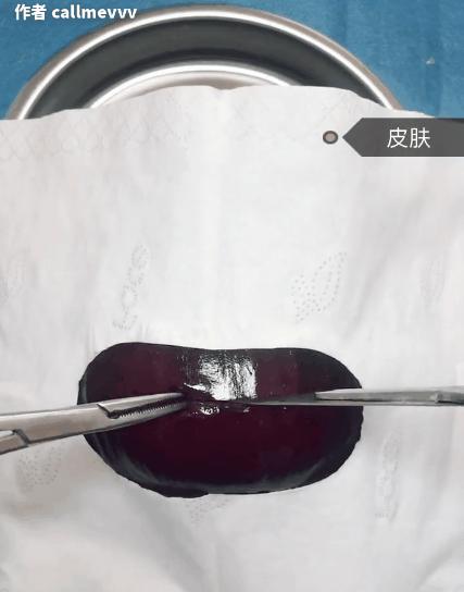 我在快手上看人切洋葱，竟然弄懂了剖腹产？