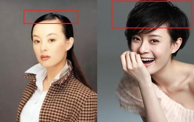 女生秃头头发干燥怎么拯救,怎样拯救秃头青年的头发