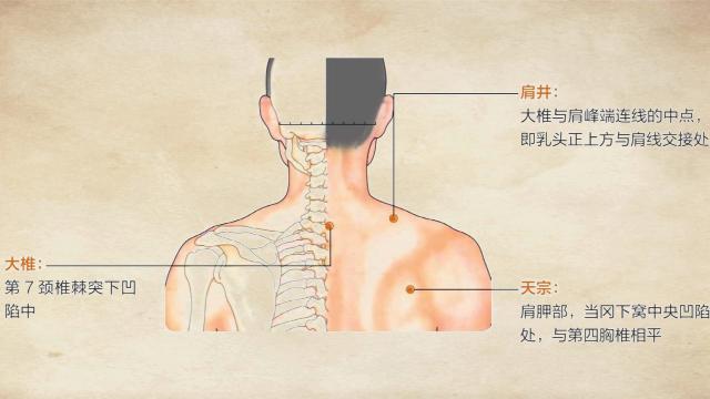 落枕治疗小妙招小视频,落枕了怎么办中医推拿有妙招