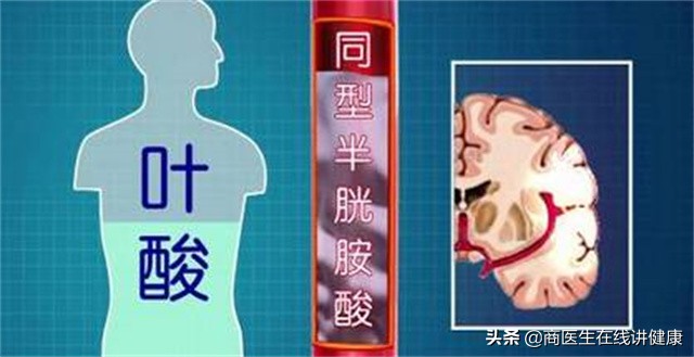 叶酸能有效预防高血压吗,叶酸对预防脑梗有作用吗