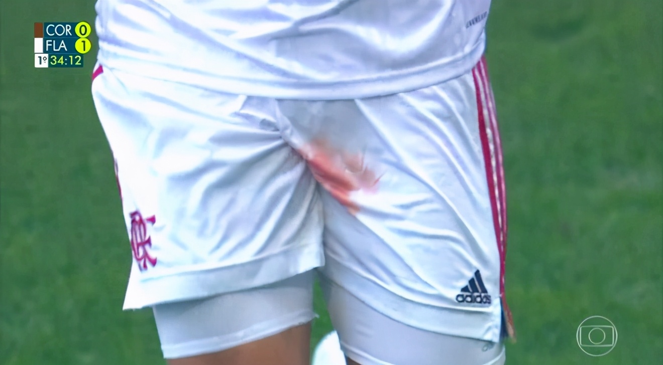 “蛋蛋”的忧伤！巴西后卫关键部位被铲伤，血染球裤仍想坚持比赛