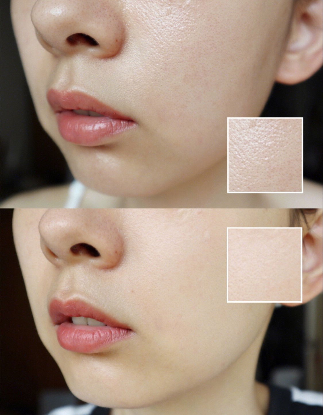 倪妮的肌肤怎么变好看,倪妮护肤