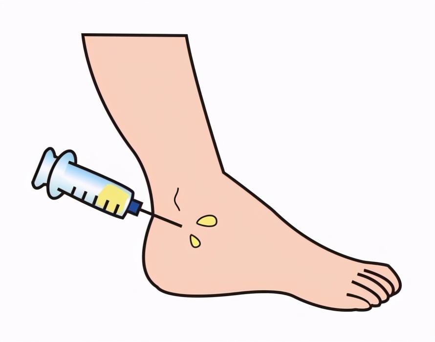 日本足协与再生法人机构签订再生医疗支援协议，修复球员运动损伤