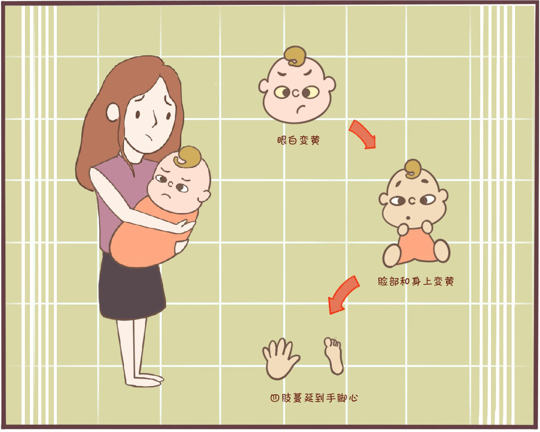 黄疸18不照黄疸晒太阳可以吗,急性黄疸肝炎晒太阳能退黄疸吗