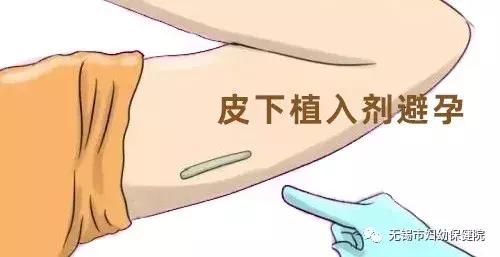 皮下埋植法避孕陕西哪里可以做,避孕节育新技术