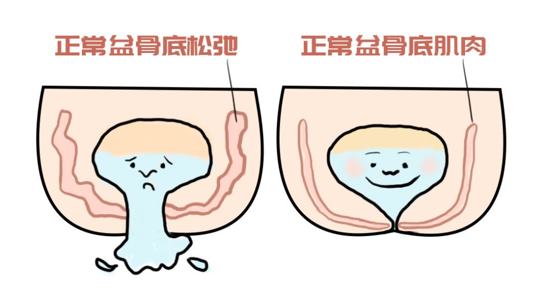 关于产后盆底肌恢复的三大谣言，害苦了多少宝妈