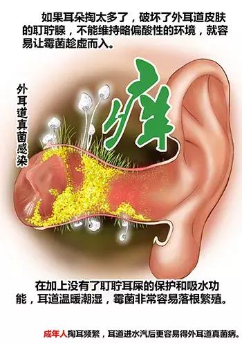 游泳耳朵里进水排不出来怎么办,游泳耳朵进水像堵了一层膜听不清
