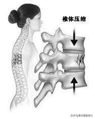 没有外伤怎么会肋骨骨折,没有外伤腰椎骨折是什么原因