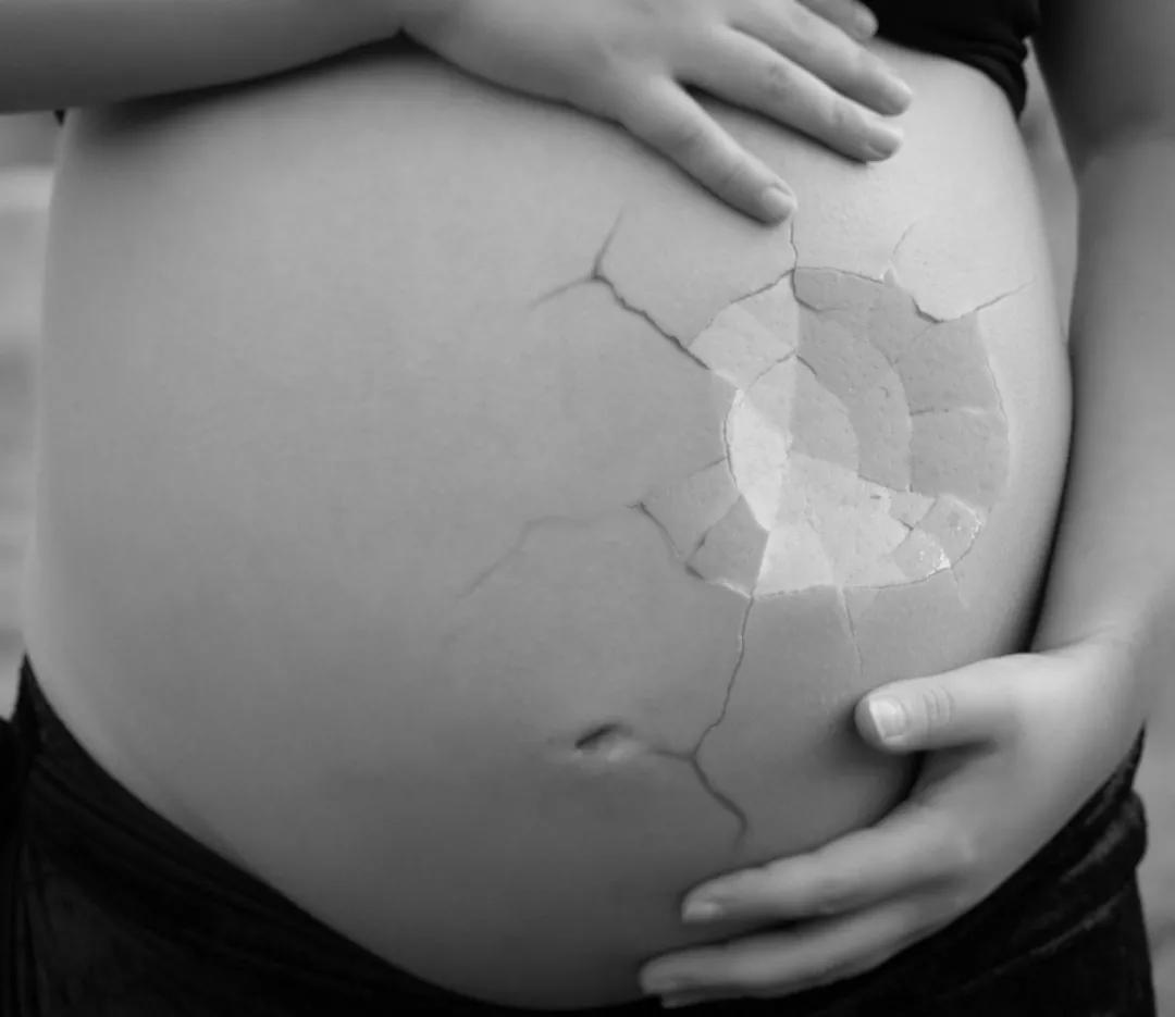 女性避孕要安全,女性健康必知长效避孕方法有哪些