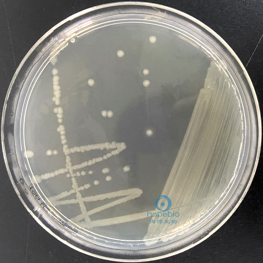 霍乱弧菌分型鉴定,霍乱弧菌的鉴定方法有几种
