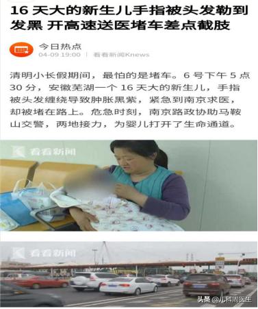 婴儿绕脖有什么危害,婴儿绕颈2圈有危险吗