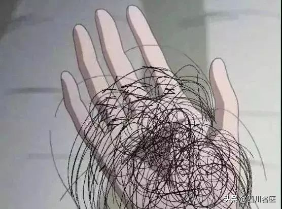 成都华西医院皮肤科雄性激素脱发,华西的皮肤科治疗脱发吗