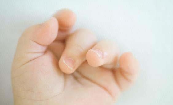 大拇指有月牙健康吗,大拇指有月牙代表什么
