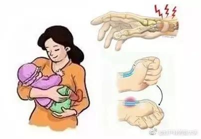 怎么用键盘不容易得腱鞘炎,键盘侠腱鞘炎