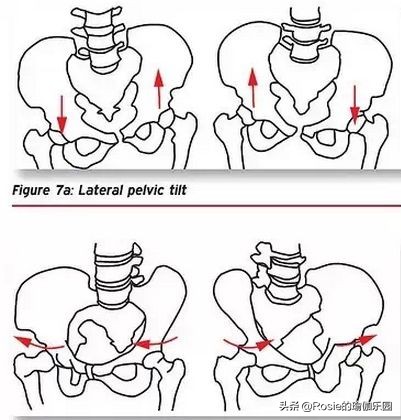 鞋子外侧总是磨怎么办,走路正确姿势鞋子总是磨外侧