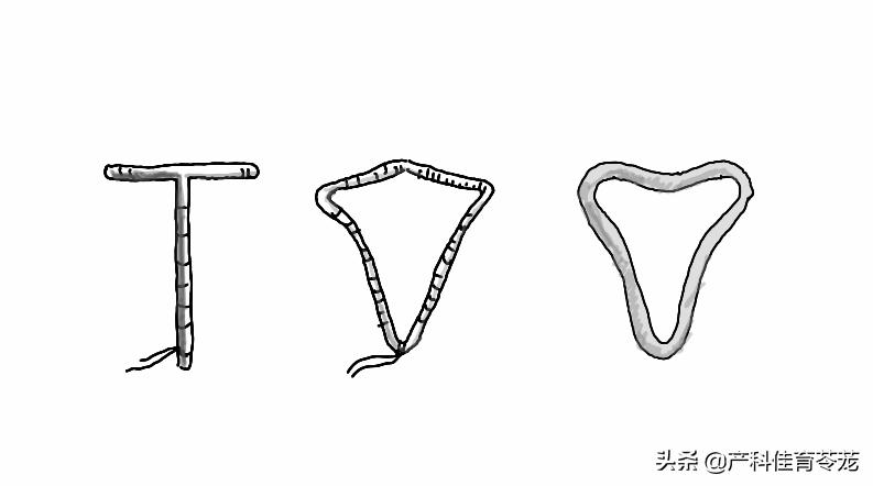 月经不调延后如何调理月经量少,月经不调不正常量少