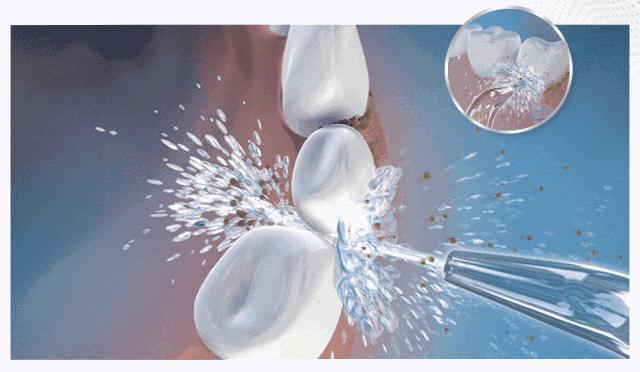 2店通用！66元抢原价420元「单人超声波洗牙套餐」