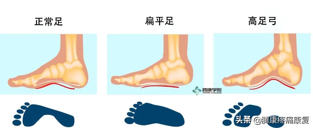 小腿全息疗法治疗颈肩腰腿痛,颈肩腰腿痛保健操完整版