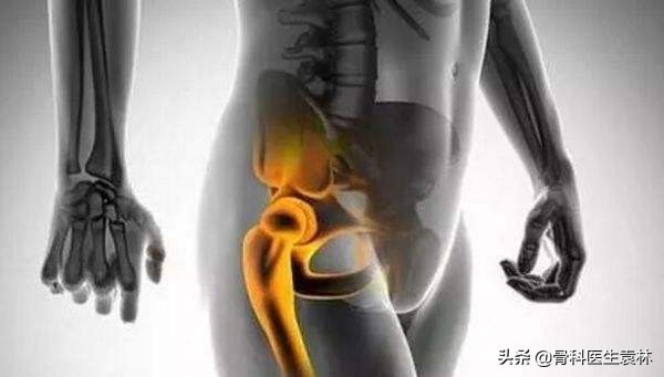 髋关节疼痛是什么原因引起的,老年女性髋关节疼痛是怎么回事
