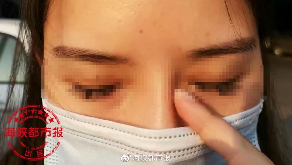 女子花6万元隆鼻,女子花8000多隆鼻竟嫌效果太自然