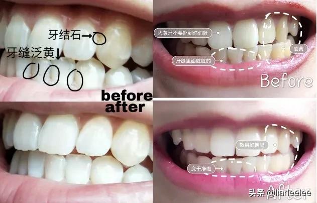 最好用的牙膏排行榜前十名,选哪个牌子的牙膏最安全好用