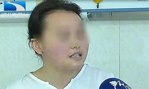 女子贴面膜毁容,女子敷面膜脸部红肿