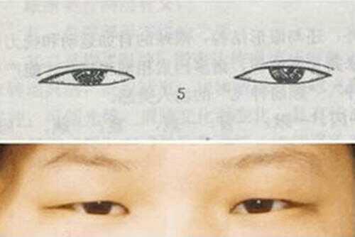 对照下你是哪种漂亮的眼型,如何区分自己的眼型