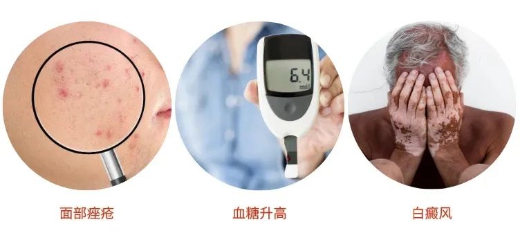 激光治疗疤痕增生需要多少钱,激光治疗疤痕费用一般多少