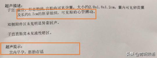 没精神老想瞌睡是怎么回事,老是没精神想睡觉看什么科