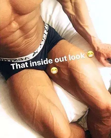 26岁健美冠军小腿静脉爆裂,22岁小伙健身过猛导致内脏撕裂