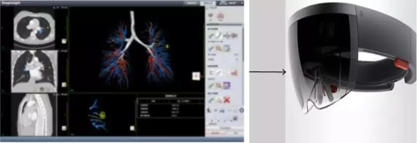 2金1银2铜！东北大学“黑科技”闪耀第23届中国发明展