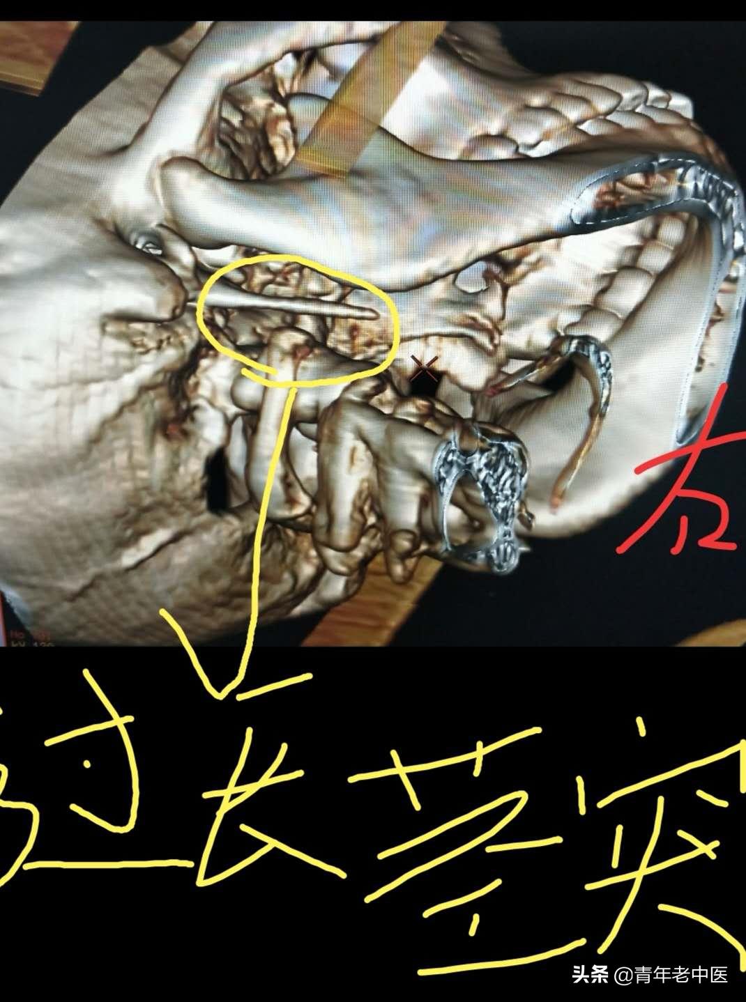什么？我咽部不舒服，你竟然让我拍X线片？你个庸医