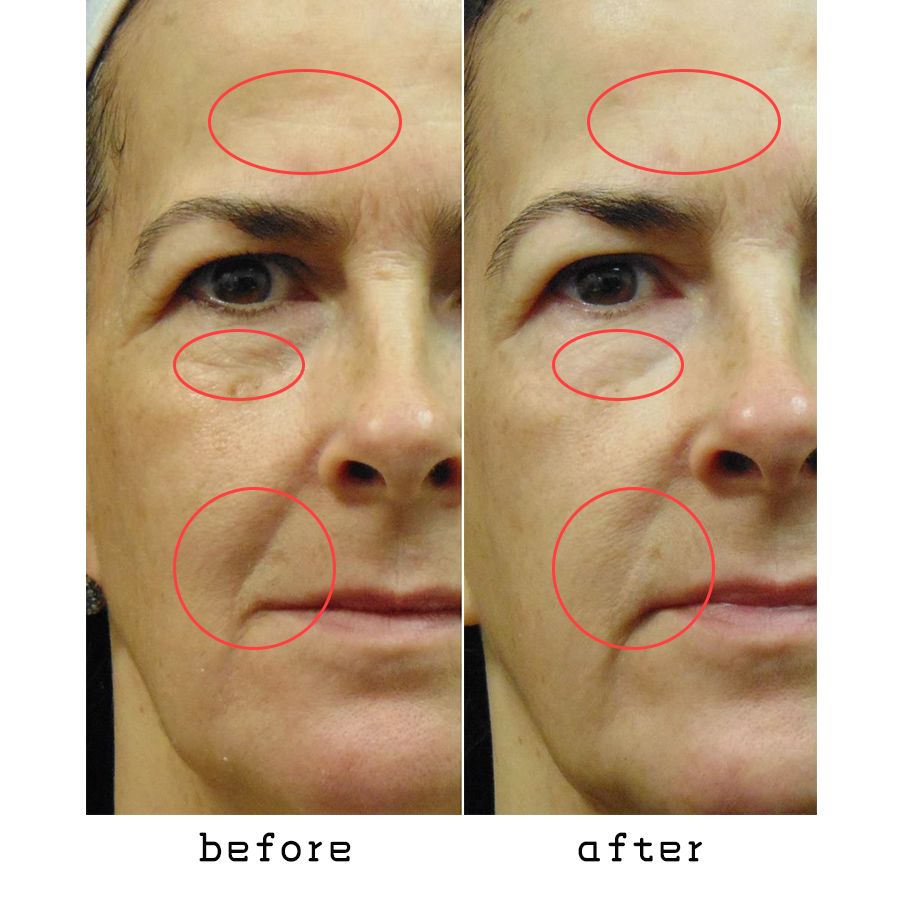 双11预售大牌折扣抢先推,双11最后一波捡漏清单速速上车