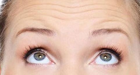鱼尾纹法令纹抬头纹显老又难看,法令纹鱼尾纹抬头纹哪个最难看