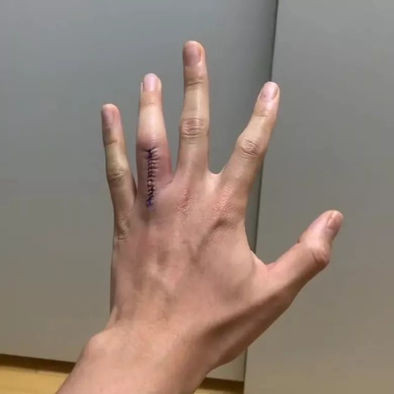 tvb明星自曝患癌症,tvb艺人自曝患上癌症