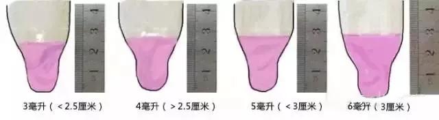 精子质量好坏标准,精子质量好坏看哪个值