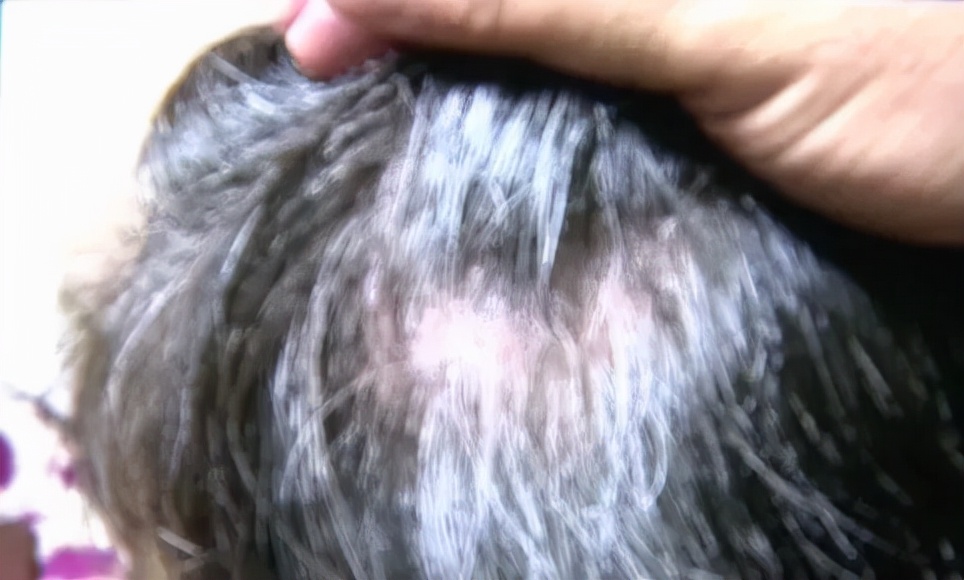 女子花了400多万整容,女子花4万元治疗白头发