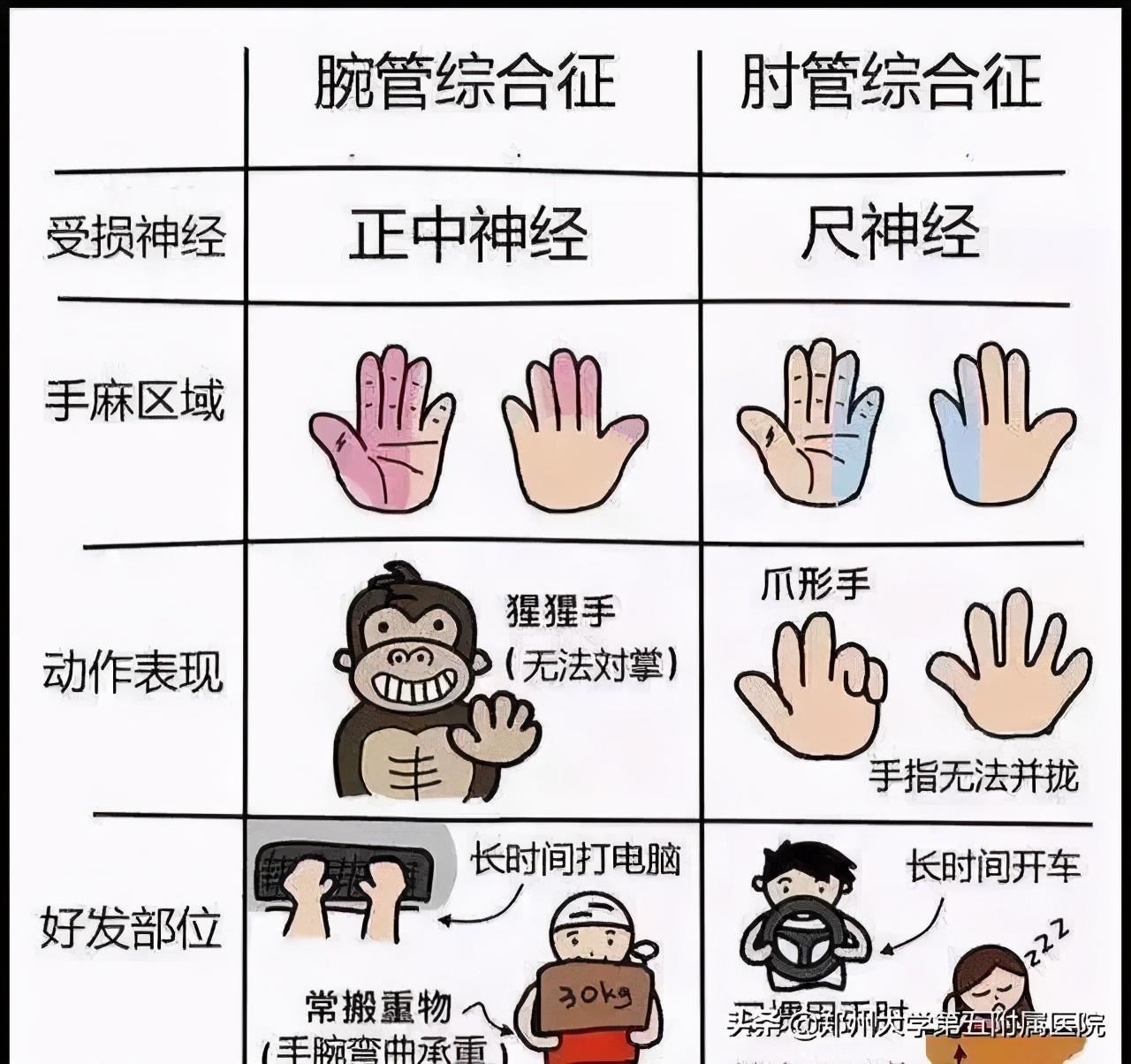 神经元病肌电图查几块肌肉,神经肌肉电图是怎么检查