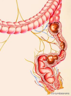 大肠不蠕动便秘严重中医能治好吗,寒积便秘的症状中医