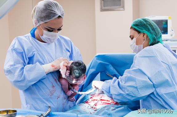 剖宫产还是顺产，该由谁做选择？