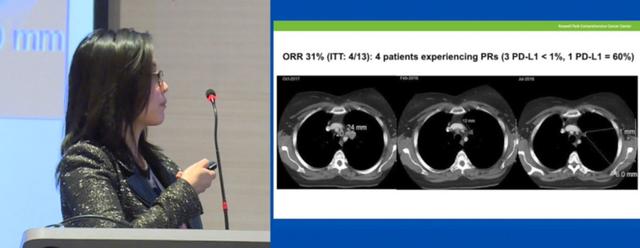 癌症疫苗将问世是真的吗,癌症疫苗或将问世