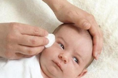 新生儿眼屎多又黄又浓稠怎么清理,七个月婴儿眼屎多鼻屎怎么回事