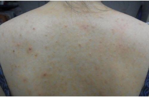 日本懒人搓澡巾,日系碳纤维搓澡巾